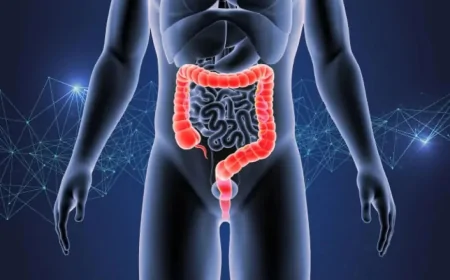 Rectal Cancer Now One-Third of All Colorectal Diagnoses in US Study